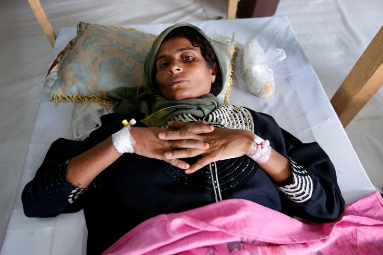 Cholera-infected patient lies on a bed while being treated at a cholera treatment center in the Red Sea port city of Hodeidah, Yemen