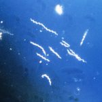 Borrelia burgdorferi, the pathogen that causes Lyme disease. Credit: CDC/Wikimedia Commons