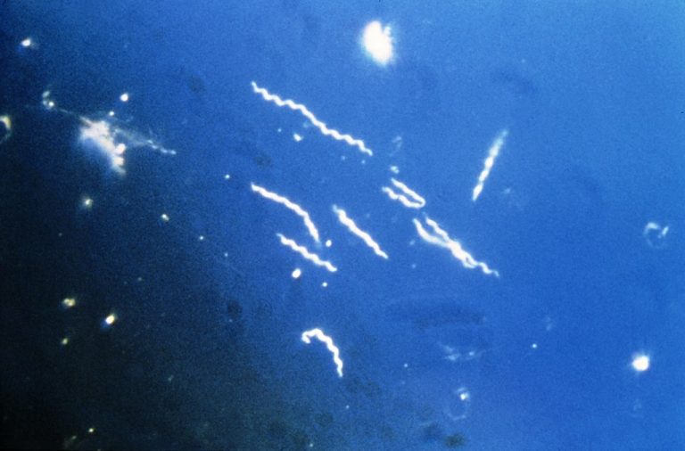 Borrelia burgdorferi, the pathogen that causes Lyme disease. Credit: CDC/Wikimedia Commons
