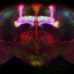 Representative image of a fly's brain. Credit: Jennet et al/Biomed Central Ltd/Wikimedia Commons CC BY 2.0