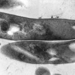 A tunneling electron microscope image of Mycobacterium tuberculosis. Credit: Wikimedia Commons
