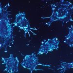 Cancer cells as seen under an electron microscope. Credit: skeeze/pixabay