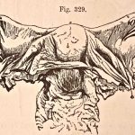 A medical illustration from 'Quain's Elements of Anatomy, Eighth Edition, Vol.II' (by William Sharpey MD, LLD, FRS L&E, Allen Thomson, MD, LLD, FRS L&E, and Edward Albert Schafer) depicts the anterior view of the uterus and its appendages, 1876. Credit: VintageMedStock/Getty Images via Undark.org