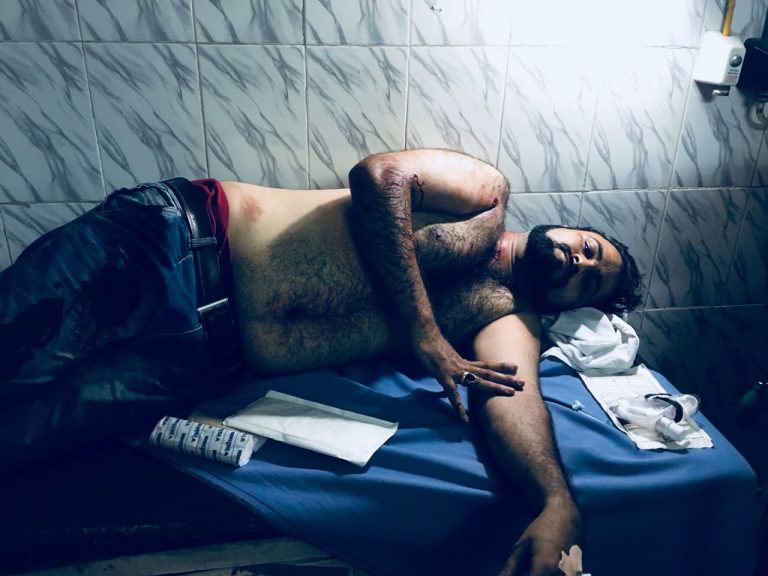 Kafeel Khan's brother, Kashif Jameel, in hospital. Credit: Special arrangement