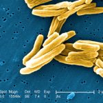 Gram positive mycobacterium tuberculosis bacteria
