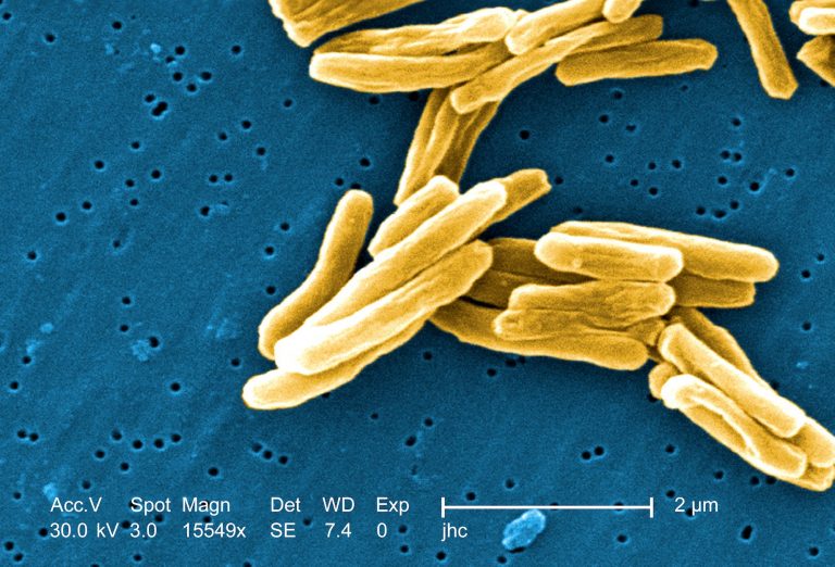 Gram positive mycobacterium tuberculosis bacteria
