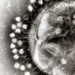 Electron Micrograph of Bacteriophages attached to a bacterial cell. Credit: Wikipedia Commons