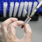 HIV_Reuters-copy-2
