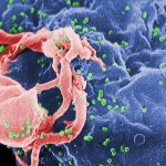 human immunodeficiency virus, HIV, AIDS, anti-retroviral therapy, HIV HAART, immune system, DNA, retrovirus, functional cure, sterilization cure, bone marrow, bone marrow transplant, blood cells, blood cancer, white blood cells, viral latency, viral lode, CD4 cells,