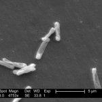 FMT, faecal microbiota transplantation, poop transplant, Clostridium difficile, ulcerative colitis, Crohn's disease, IBS, gastroenterology, chronic disease,