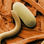 1245px-Soybean_cyst_nematode_and_egg_SEM