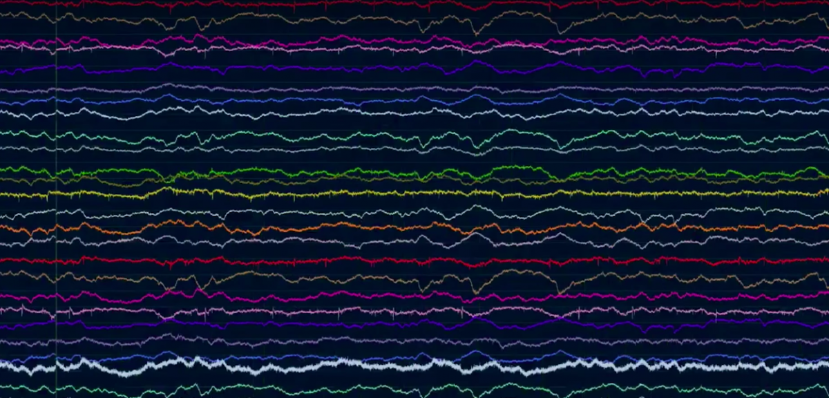 A representative sample of what brain signals look like, from the Neuralink presentation. Photo: Neuralink/YouTube