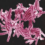 Mycobacterium_tuberculosis_Bacteria_the_Cause_of_TB_5149398656