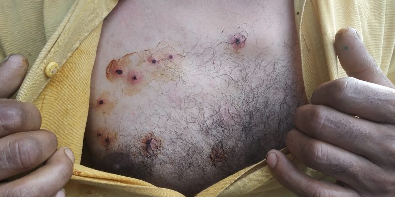 100 Days and Counting: Glimpses of the Lockdown, Shutdown in Kashmir