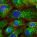 national-cancer-institute-W2OVh2w2Kpo-unsplash
