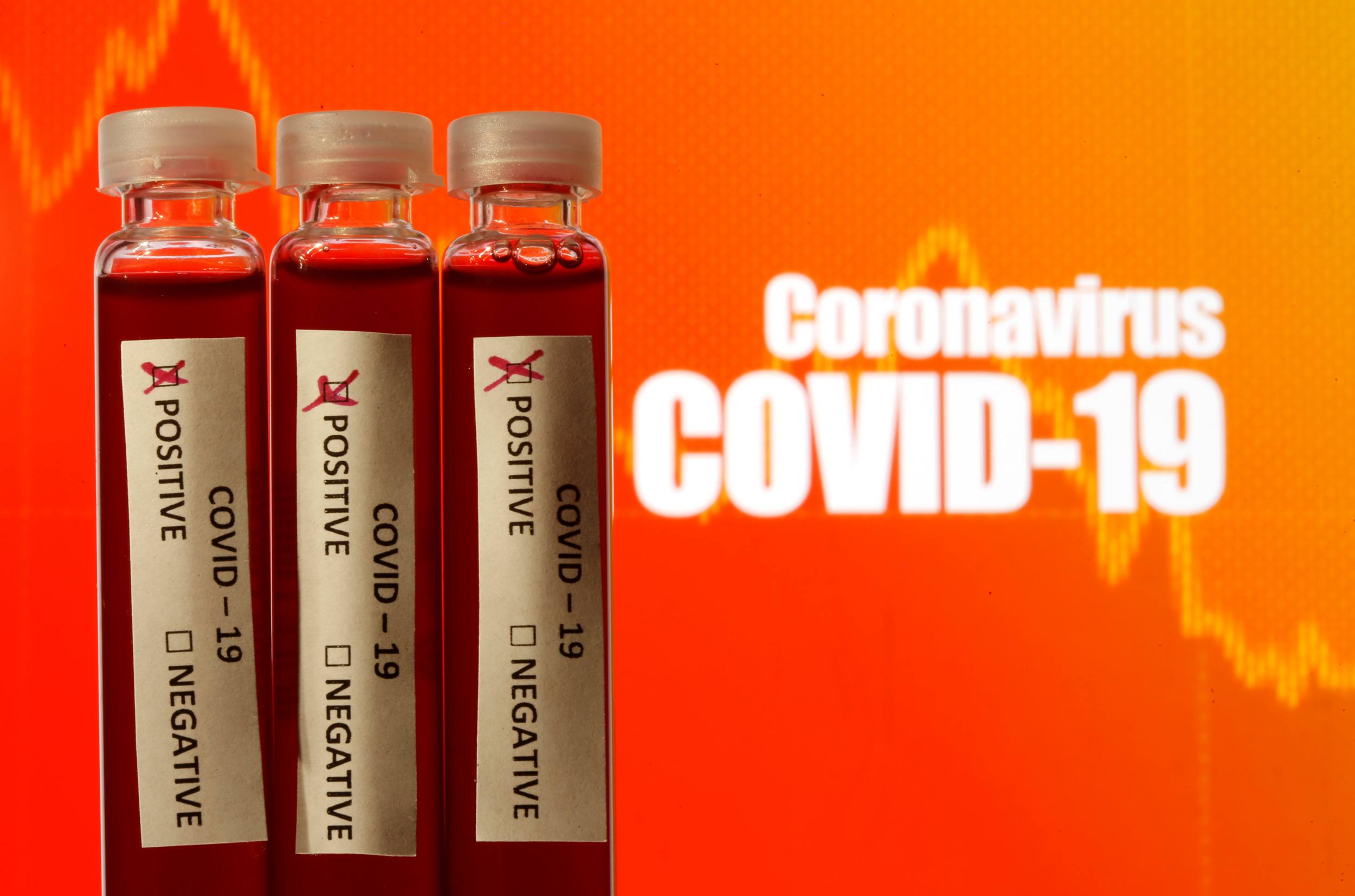 Fake blood is seen in test tubes labelled with the coronavirus (COVID-19) in this illustration