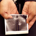 FILE PHOTO: A patient from Texas holds a sonogram that she received at the Hope Medical Group for Women in Shreveport