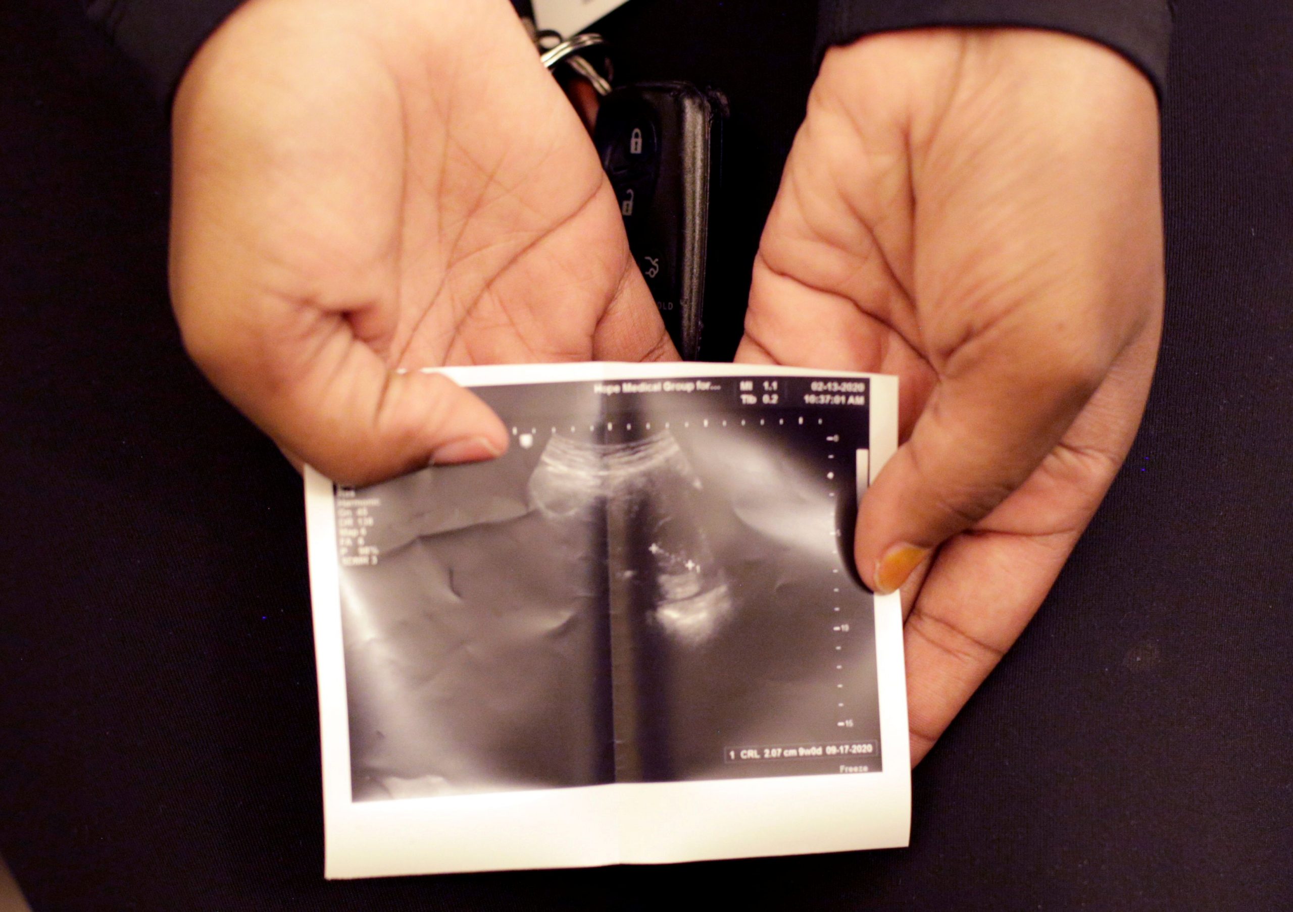 FILE PHOTO: A patient from Texas holds a sonogram that she received at the Hope Medical Group for Women in Shreveport