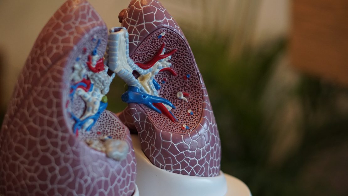 Air Pollution Can Cause Lung Cancer in NonSmokers The Wire Science