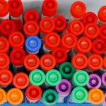 FILE PHOTO: Specimens from coronavirus disease (COVID-19) tests are logged to processed for a positive or negative result at the UW Medicine Virology lab in Seattle,