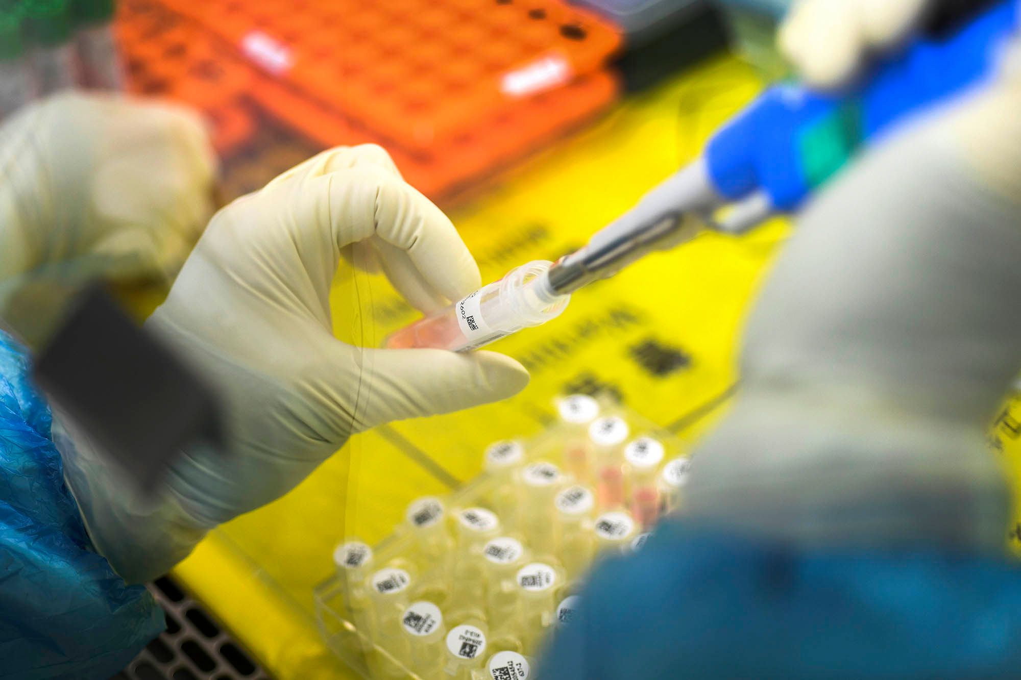 coronavirus-26