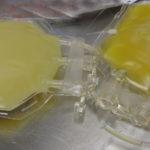 Lipemic_plasma
