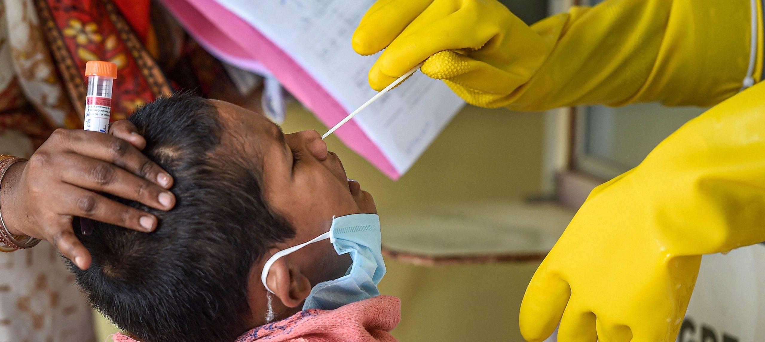 COVID19 test  in Chennai