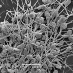 Human_Spermatozoa,_Scanning_Electron_Micrograph