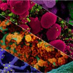 novel coronavirus