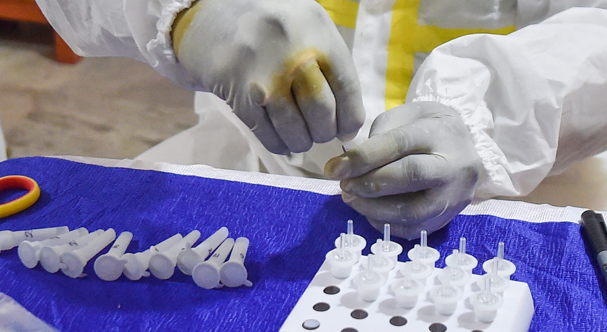 COVID-19 rapid antigen testing in Kolkata