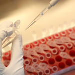 FILE PHOTO: A scientist dilutes samples during the research and development of a COVID-19 vaccine in St Petersburg