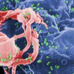 HIV-budding-Color-resized