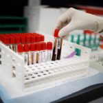 FILE PHOTO: Coronavirus disease (COVID-19) vaccination study at the Research Centers of America in Hollywood
