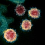 1280px-Novel_Coronavirus_SARS-CoV-2