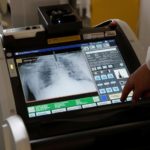 A member of the medical staff makes a lung X-ray to a patient suffering from coronavirus disease (COVID-19) at the intensive care unit at the Institut Mutualiste Montsouris (IMM) hospital in Paris as the spread of the coronavirus disease continues in France, April 6, 2020. REUTERS/Benoit Tessier