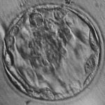 Blastocyst