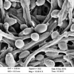 lossy-page1-1024px-SEM_of_C_albicans.tif