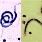 parasites