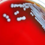 Gram negative burkholderia pseudomallei bacteria which was grown on a medium of sheeps blood agar