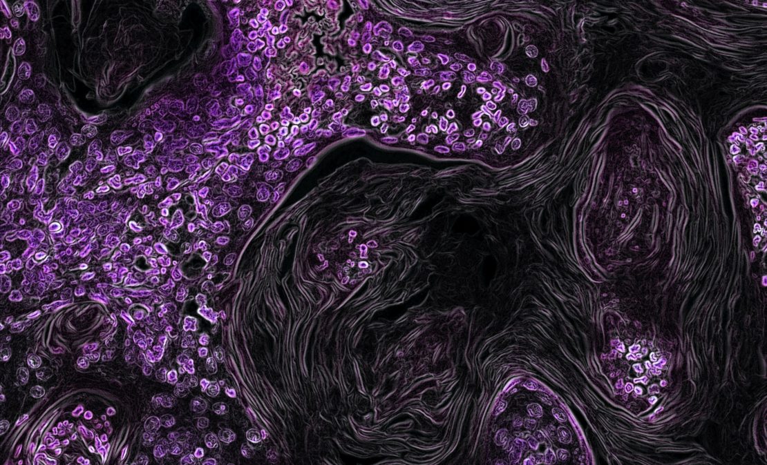 Contagious Cancers in Animals Are a Warning to Humans The Wire Science