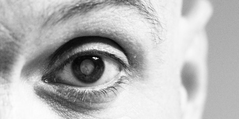Bihar: Police Register FIR for Botched Cataract Surgeries - Vimarsana News