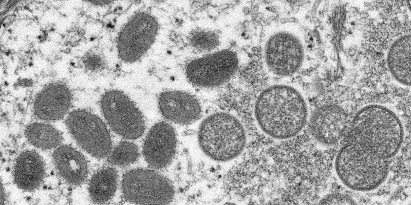 Seven Countries in Europe and North America Report Monkeypox Cases - Vimarsana News