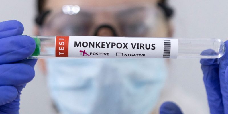 Delhi Reports Fourth Case of Monkeypox - Vimarsana News