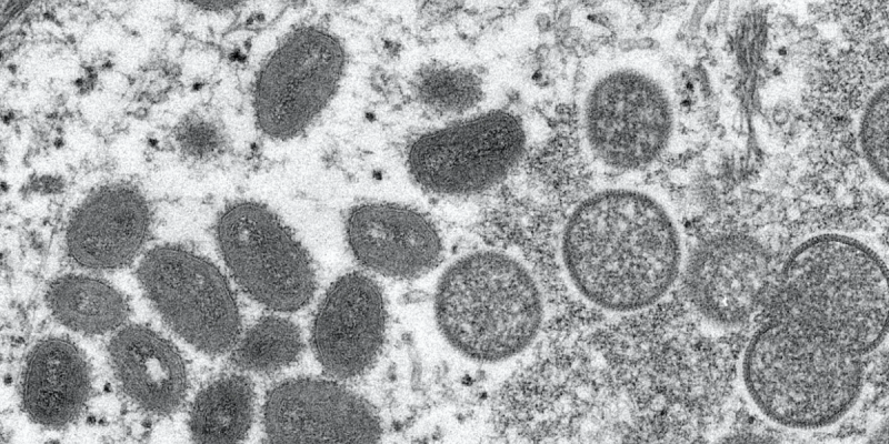 Kerala Minister Confirms First Monkeypox Death in India - Vimarsana News