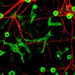 Microglia_and_neurons