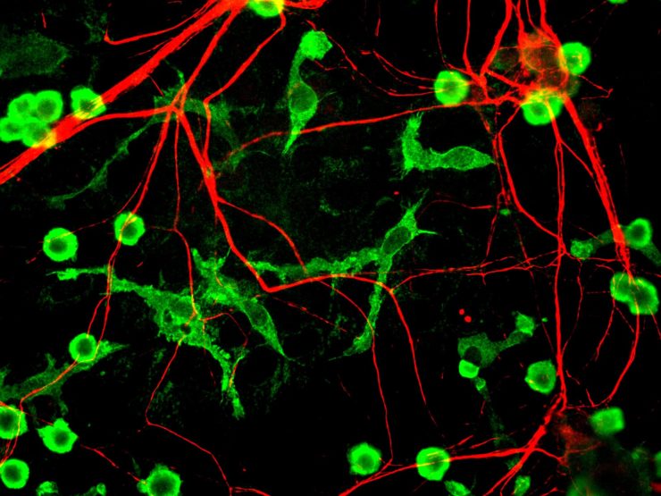 Does the Immune System Know Why Risk of Autism and Alzheimer's Differs by Sex? – The Wire Science - Vimarsana News