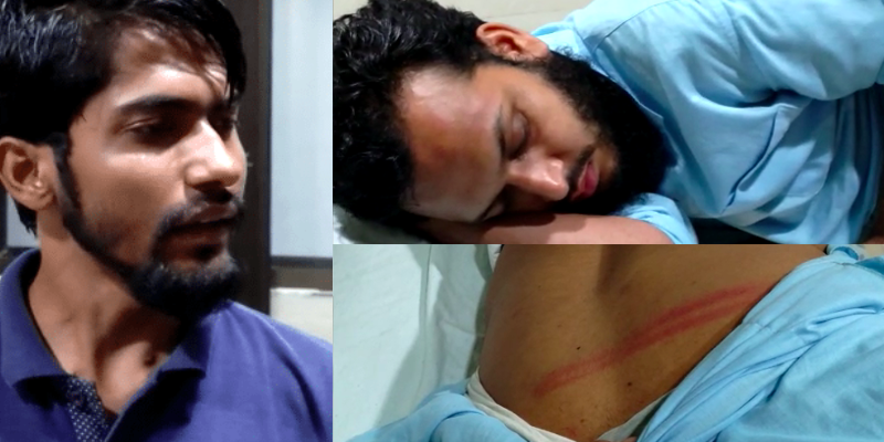 AMU Students Allege Brutal Beating by Aligarh Rail Police; 2 Cops Suspended - Vimarsana News