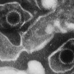 Epstein_Barr_Virus_virions_EM_10.1371_journal.pbio.0030430.g001-L