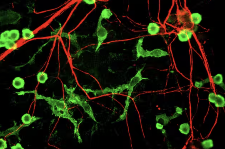 The Brain's Own Immune Cells Could Stave Off Alzheimer's and Other Neurodegenerative Diseases – The Wire Science - Vimarsana News