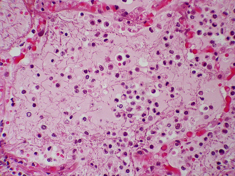 No New Pathogen Who S Line Why China What We Know About The